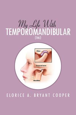 Imagen del vendedor de My Life with Temporomandibular (Tmj): Living with Tmj (Paperback or Softback) a la venta por BargainBookStores