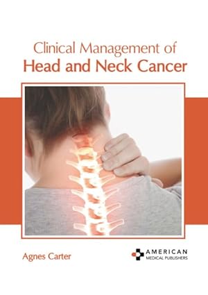 Bild des Verkufers fr Clinical Management of Head and Neck Cancer zum Verkauf von GreatBookPrices