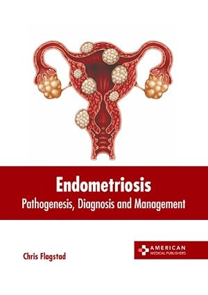 Seller image for Endometriosis : Pathogenesis, Diagnosis and Management for sale by GreatBookPrices