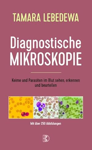 Bild des Verkufers fr Diagnostische Mikroskopie : Keime und Parasiten im Blut sehen, erkennen und beurteilen zum Verkauf von AHA-BUCH GmbH