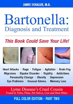 Imagen del vendedor de Bartonella: Diagnosis and Treatment: Part 2 of 2, Full Color Edition a la venta por -OnTimeBooks-