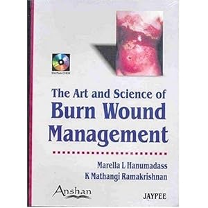 Bild des Verkufers fr Art and Science of Burn Wound Management zum Verkauf von WeBuyBooks