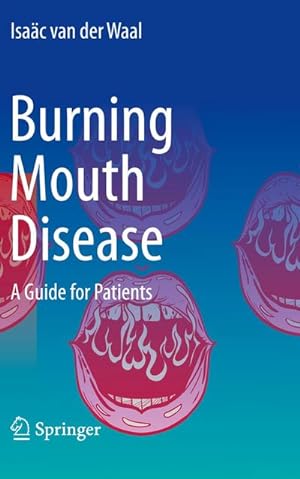 Bild des Verkufers fr Burning Mouth Disease : A Guide for Patients zum Verkauf von AHA-BUCH GmbH