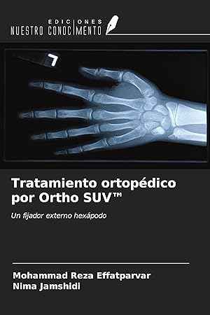 Seller image for Tratamiento ortopdico por Ortho SUV  for sale by moluna