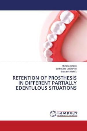 Imagen del vendedor de RETENTION OF PROSTHESIS IN DIFFERENT PARTIALLY EDENTULOUS SITUATIONS a la venta por BuchWeltWeit Ludwig Meier e.K.