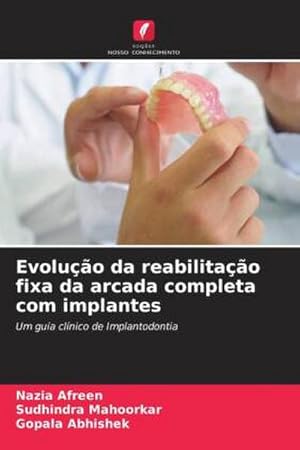 Seller image for Evoluo da reabilitao fixa da arcada completa com implantes : Um guia clnico de Implantodontia for sale by AHA-BUCH GmbH