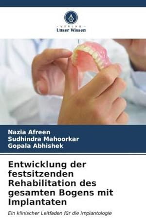 Seller image for Entwicklung der festsitzenden Rehabilitation des gesamten Bogens mit Implantaten for sale by BuchWeltWeit Ludwig Meier e.K.