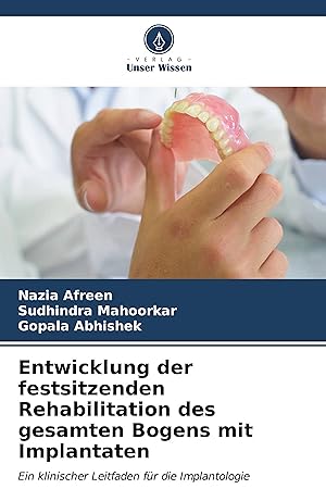 Seller image for Entwicklung der festsitzenden Rehabilitation des gesamten Bogens mit Implantaten for sale by moluna