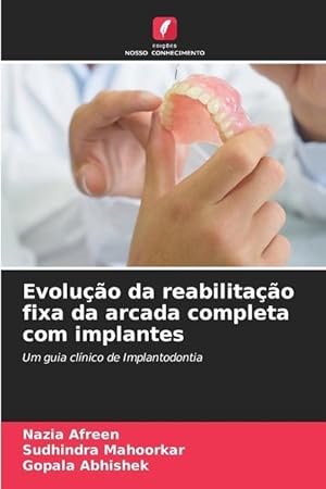 Seller image for Evoluo da reabilitao fixa da arcada completa com implantes for sale by moluna