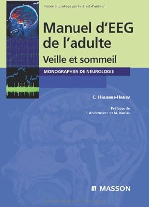 Seller image for Manuel d'EEG de l'adulte: Veille et sommeil for sale by WeBuyBooks