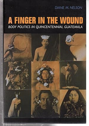 Seller image for A Finger in the Wound: Body Politics in Quincentennial Guatemala for sale by EdmondDantes Bookseller
