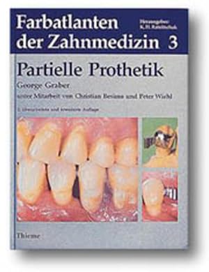 Bild des Verkufers fr Farbatlanten der Zahnmedizin, Bd.3, Partielle Prothetik zum Verkauf von Studibuch