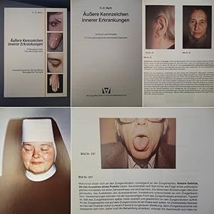 Bild des Verkufers fr uere Kennzeichen innerer Erkrankungen, Lehrbuch und Farbatlas fr Pathophysiognomie und visuelle Diagnostik zum Verkauf von Galerie fr gegenstndliche Kunst