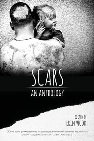 Seller image for Scars : An Anthology for sale by AHA-BUCH GmbH