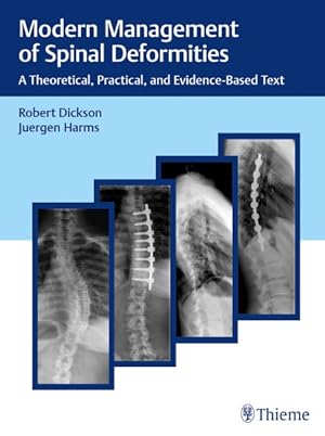 Image du vendeur pour Modern Management of Spinal Deformities : A Theoretical, Practical, and Evidence-based Text mis en vente par GreatBookPrices