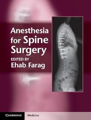 Immagine del venditore per Anesthesia for Spine Surgery (Cambridge Medicine (Hardcover)) venduto da WeBuyBooks