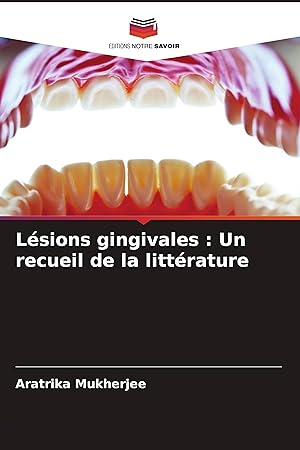 Bild des Verkufers fr Lsions gingivales : Un recueil de la littrature zum Verkauf von moluna