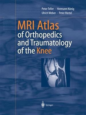 Seller image for MRI Atlas of Orthopedics and Traumatology of the Knee for sale by GreatBookPrices
