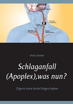 Image du vendeur pour Schlaganfall (Apoplex), was nun? mis en vente par BuchWeltWeit Ludwig Meier e.K.