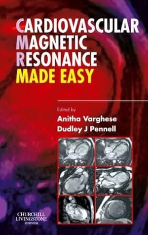 Immagine del venditore per Cardiovascular Magnetic Resonance Made Easy venduto da BuchWeltWeit Ludwig Meier e.K.