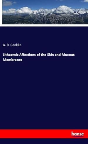 Seller image for Lithaemic Affections of the Skin and Mucous Membranes for sale by BuchWeltWeit Ludwig Meier e.K.