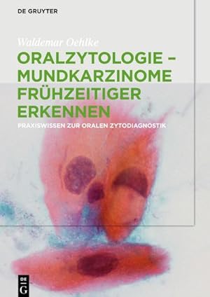 Bild des Verkufers fr Oralzytologie - Mundkarzinome frhzeitiger erkennen zum Verkauf von BuchWeltWeit Ludwig Meier e.K.
