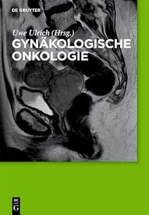 Seller image for Gynkologische Onkologie for sale by BuchWeltWeit Ludwig Meier e.K.