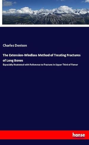 Image du vendeur pour The Extension-Windlass Method of Treating Fractures of Long Bones mis en vente par BuchWeltWeit Ludwig Meier e.K.