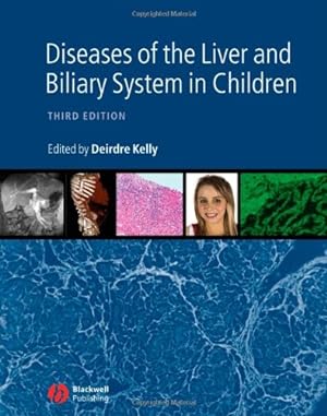 Bild des Verkufers fr Diseases of the Liver and Biliary System in Children zum Verkauf von WeBuyBooks