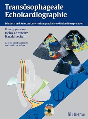 Seller image for Transsophageale Echokardiographie: Lehrbuch und Atlas zur Untersuchungstechnik und Befundinterpretation for sale by Studibuch