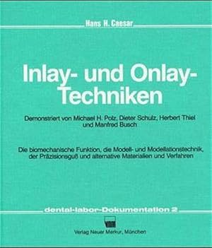 Seller image for Inlay- und Onlay-Techniken: Dokumentation der C.-Hafner-Master-Workshops 1987. Die biochemische Funktion, die Modell- und Modellationstechnik, der . und alternative Materialien und Verfahren for sale by Studibuch