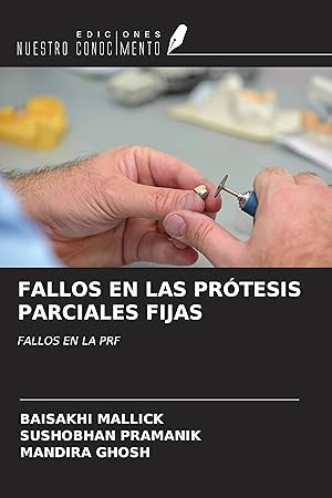 Imagen del vendedor de FALLOS EN LAS PRTESIS PARCIALES FIJAS a la venta por moluna