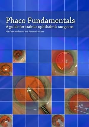 Bild des Verkufers fr Phaco Fundamentals: A Guide for Trainee Ophthalmic Surgeons zum Verkauf von WeBuyBooks