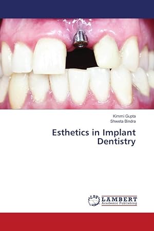 Seller image for Esthetics in Implant Dentistry for sale by moluna