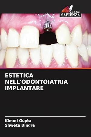 Seller image for ESTETICA NELL ODONTOIATRIA IMPLANTARE for sale by moluna