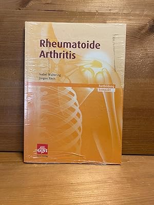 Rheumatoide Arthritis: Fortbildung kompakt