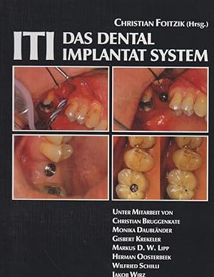 Imagen del vendedor de ITI - Das Dental- Implantat- System. a la venta por Bcher bei den 7 Bergen