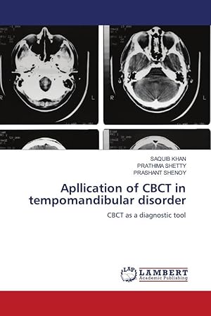 Seller image for Apllication of CBCT in tempomandibular disorder for sale by moluna