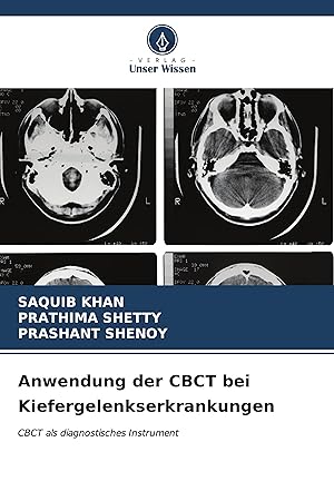 Seller image for Anwendung der CBCT bei Kiefergelenkserkrankungen for sale by moluna