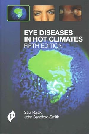 Seller image for Eye Diseases in Hot Climates for sale by GreatBookPrices