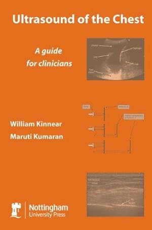 Bild des Verkufers fr Ultrasound of the Chest: A Guide for Clinicians zum Verkauf von WeBuyBooks