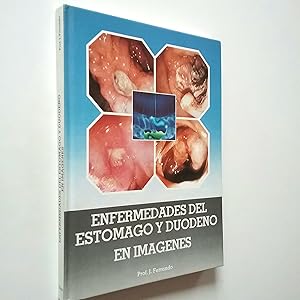 Imagen del vendedor de Enfermedades de estmago y duodeno en imgenes a la venta por MAUTALOS LIBRERA