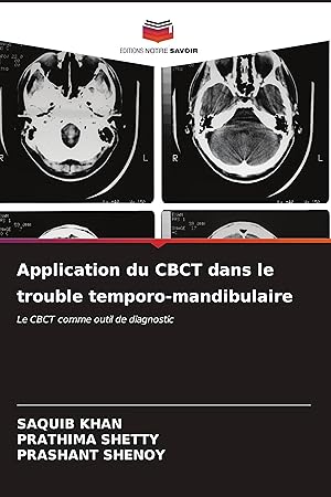 Seller image for Application du CBCT dans le trouble temporo-mandibulaire for sale by moluna