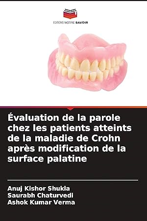 Bild des Verkufers fr valuation de la parole chez les patients atteints de la maladie de Crohn aprs modification de la surface palatine zum Verkauf von moluna