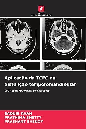 Seller image for Aplicao da TCFC na disfuno temporomandibular for sale by moluna