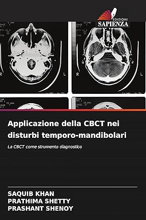 Seller image for Applicazione della CBCT nei disturbi temporo-mandibolari for sale by moluna