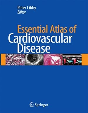 Immagine del venditore per Essential Atlas of Cardiovascular Disease venduto da GreatBookPrices