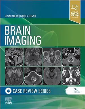 Bild des Verkufers fr Brain Imaging Case Review zum Verkauf von moluna