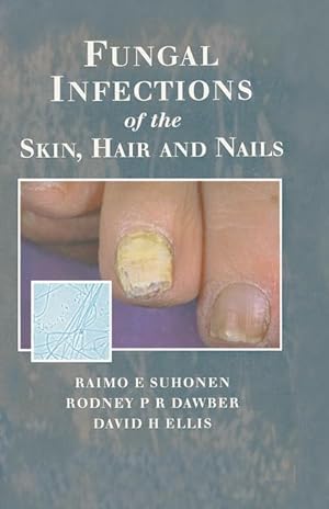 Seller image for Fungal Infections of the Skin and Nails for sale by moluna