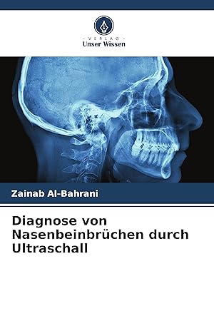 Seller image for Diagnose von Nasenbeinbrchen durch Ultraschall for sale by moluna